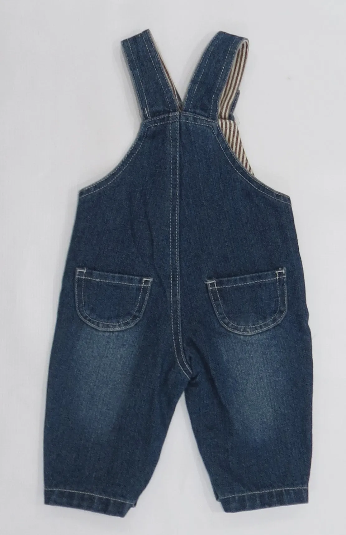 Overall B1